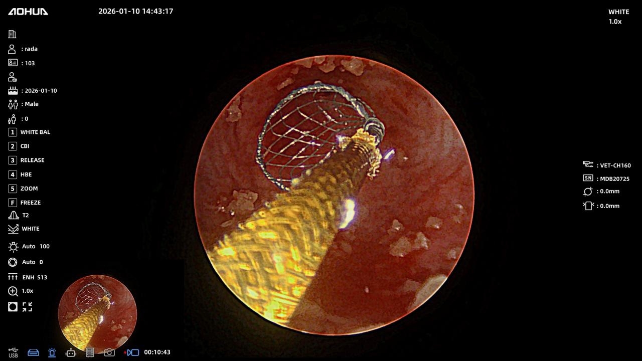 Литотрипсия дробление камней у кошек