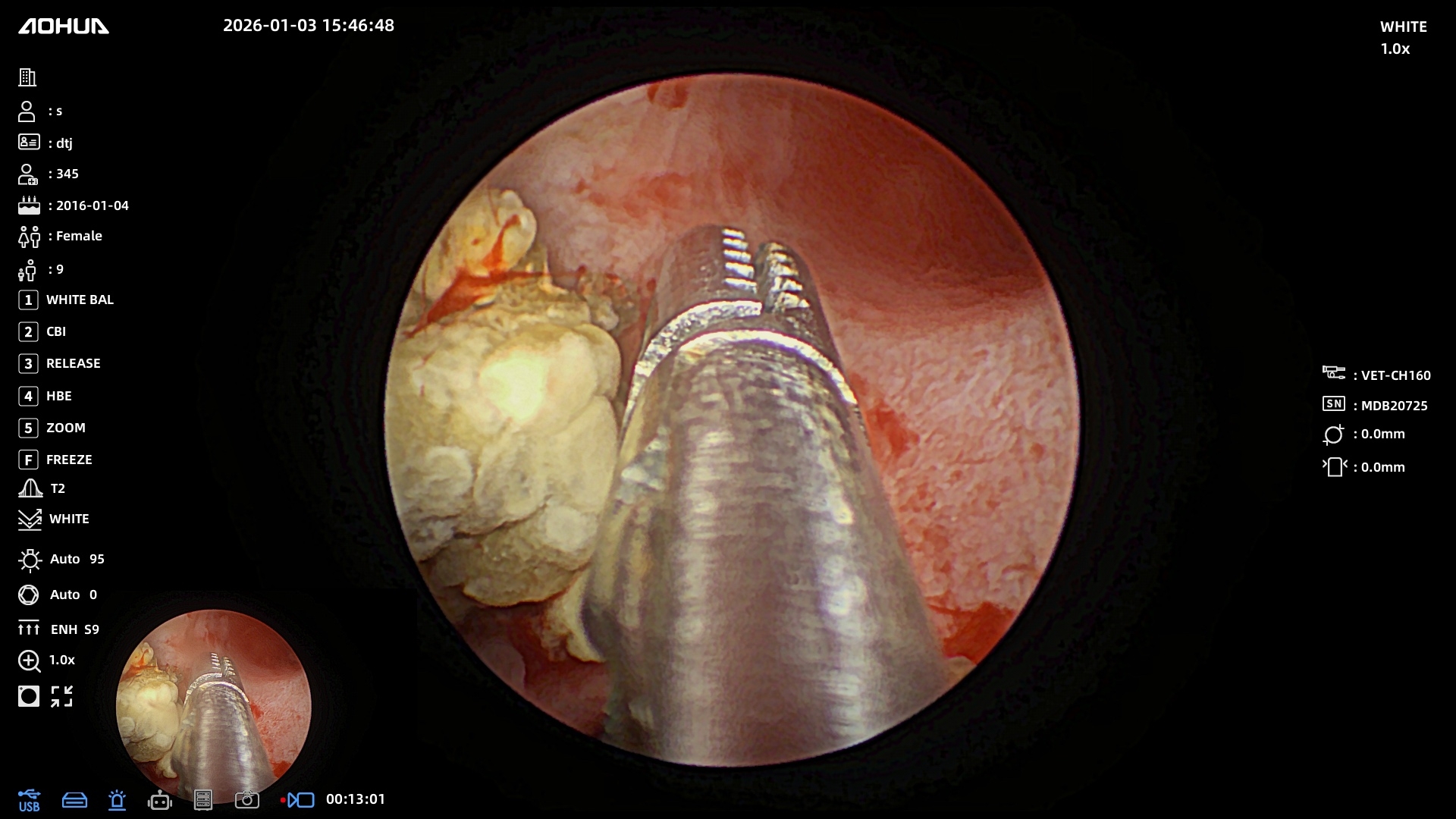 Литотрипсия дробление камней у собак