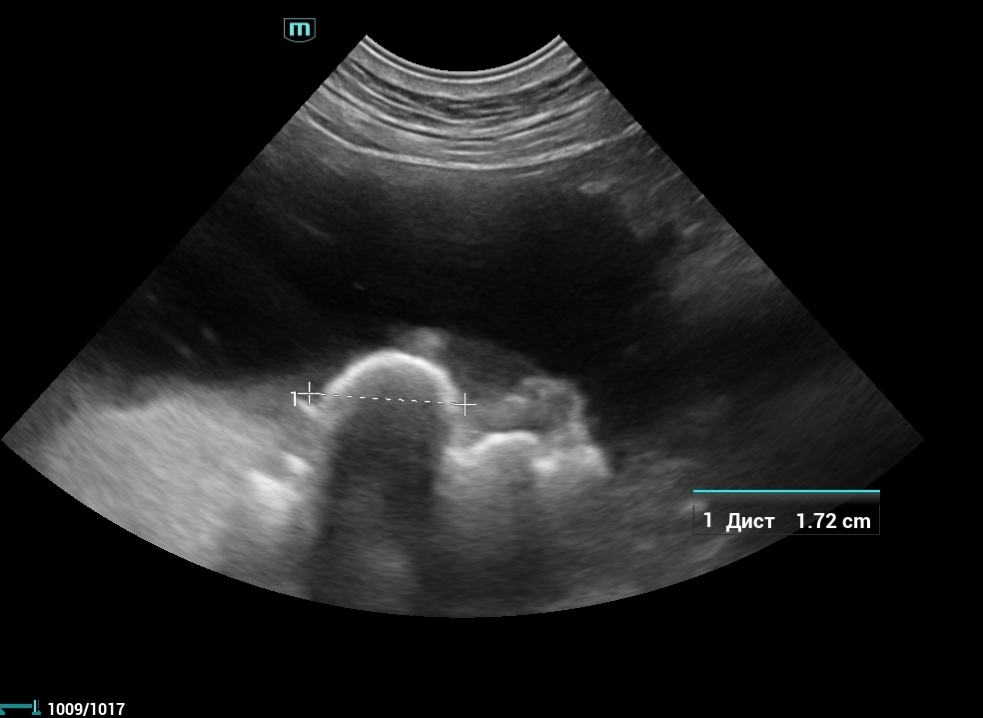 Удаление камней из мочевого пузыря собаки